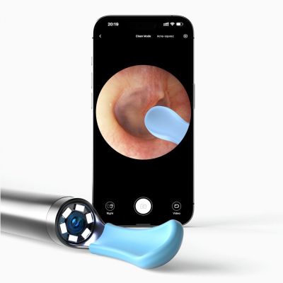 3. Bebird R1+ Biały | Otoskop z kamerą do czyszczenia uszu | 1080p, 180mAh