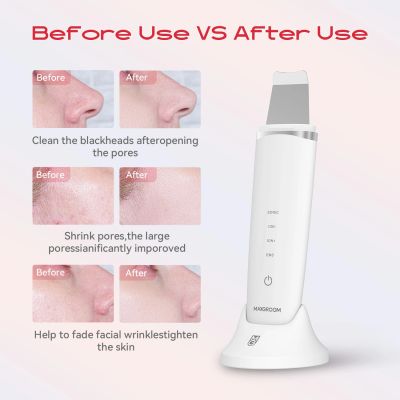 9. Urządzenie do peelingu kawitacyjnego MAXGROOM M-169 ultradźwiękowe z terapią światłem LED - białe