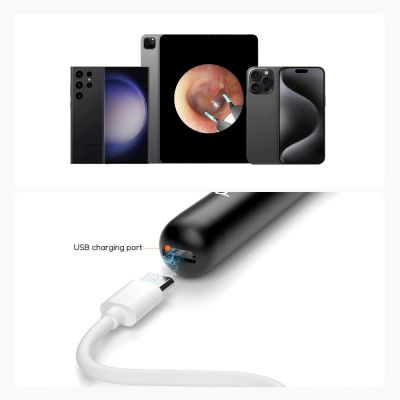 4. Bebird R1+ Biały | Otoskop z kamerą do czyszczenia uszu | 1080p, 180mAh