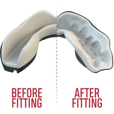 3. Ochraniacze zębów OZ-TT "Extro Fangz" czarny
